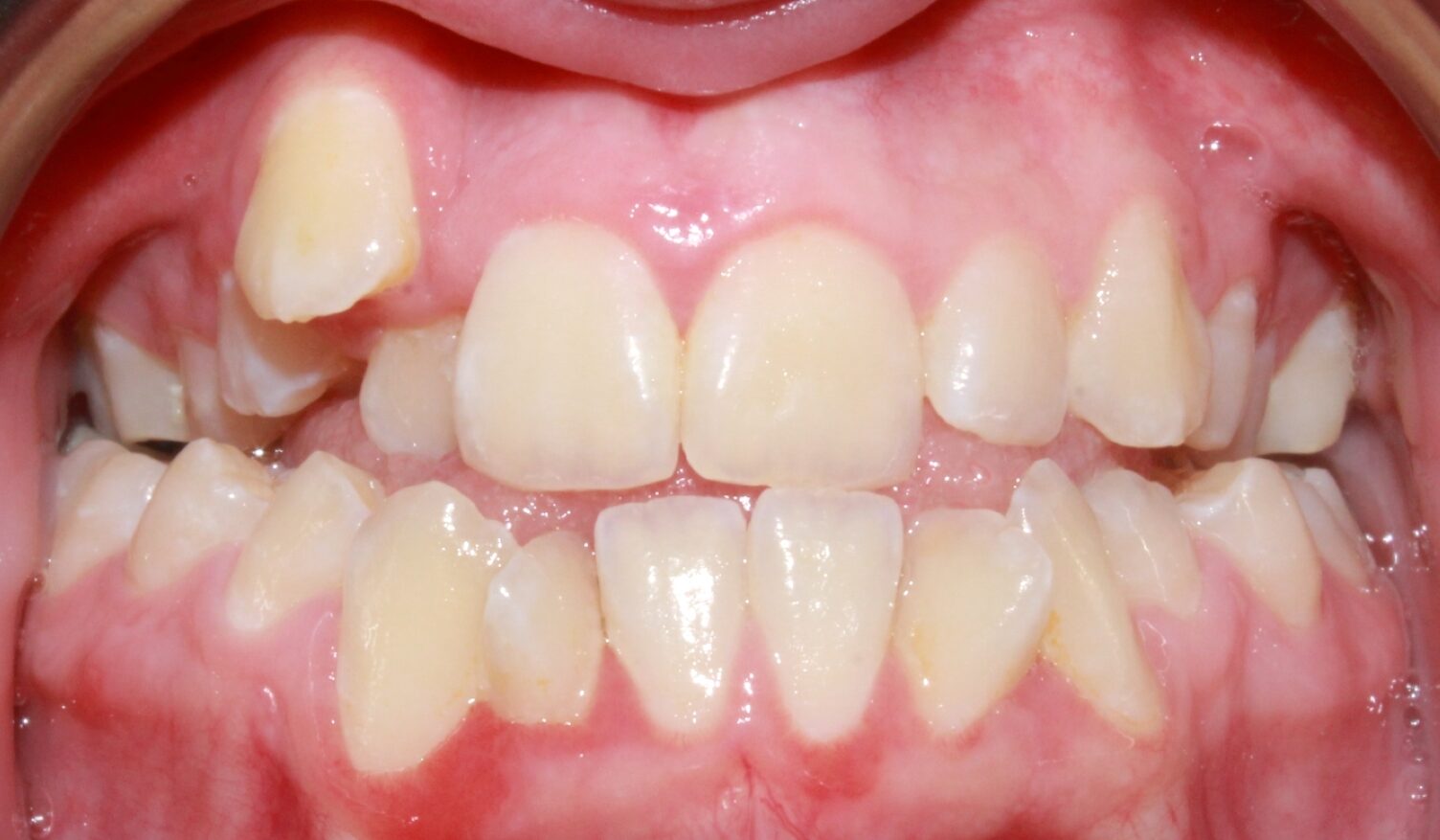 Before